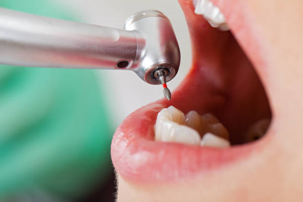 Best Emergency Treatment for Dental Infections or Abscesses in Alton, TX